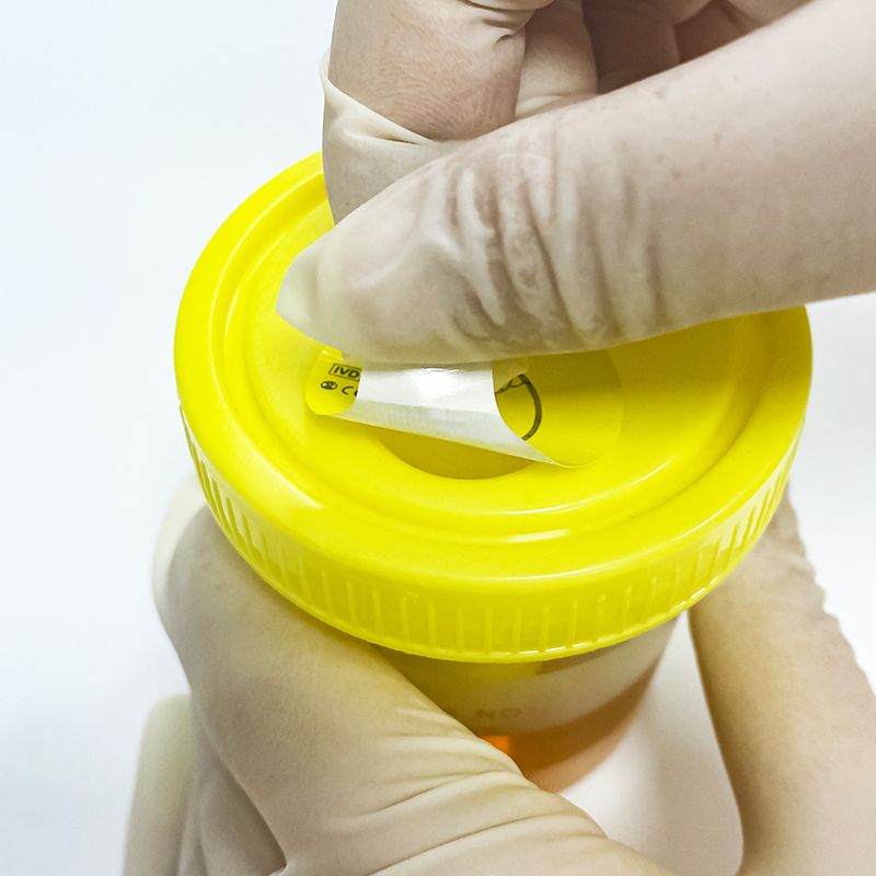 urine container amazon lab