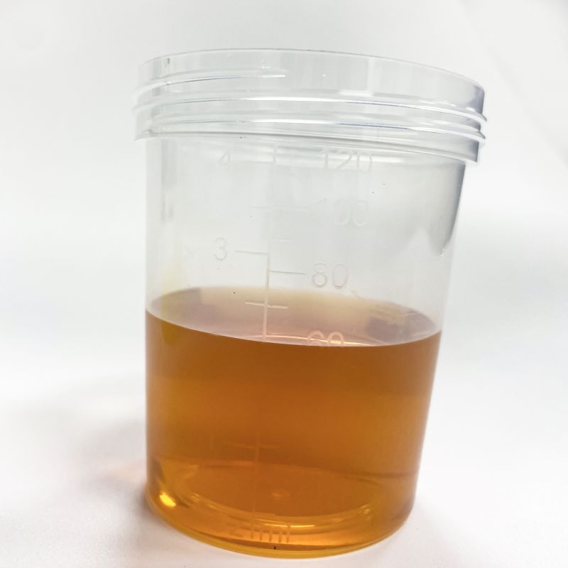 Tube d'urine sous vide 7ml récipient d'urine sarstedt Fabricant et  fournisseur
